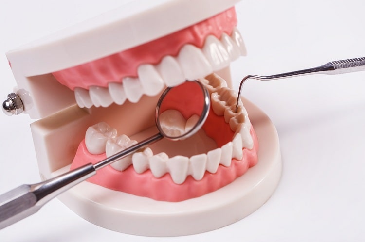تبلیغ دندانپزشکی